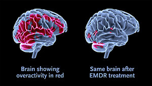 Home. EMDR image